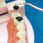 🏆Ingénierie de précision allemande ! Pointe ultra-fine de 0.1 mm pour un nettoyage précis entre les dents.✨