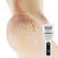🏆75% de réduction pour une durée limitée✨🌸Portable Electric Foot Callus Remover